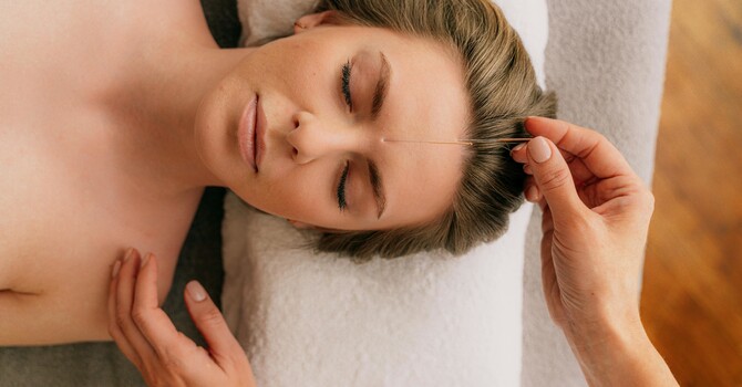 The Benefits of Weekly Acupuncture: A Path to Consistent Wellness image