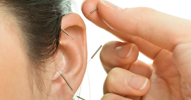 Unlock the Power of Ear Acupuncture