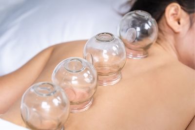 cups on woman's back